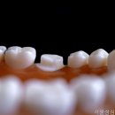성심치과의원 네이버블로그