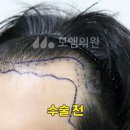모엠