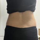 운동없이 다이어트 -8kg, 상상만큼 쉬운 다이어트 의원 내돈내산 재방문 1회차 후기