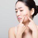 소담 인셀덤