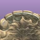 새로치과기공소 이미지