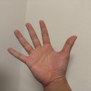 이 손가락 동작이 안된다면 당장 병원 가세요, 몸이 보내는 SOS 신호입니다. 이미지