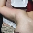 바디슬림 | 대전신부관리 바디슬림에어젯 팔뚝관리 후기 에트나샵에스테틱