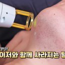 리마인드피부과의원 네이버블로그