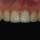 멍크라운 이미지