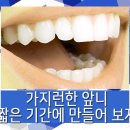 유씨캘리포니아치과의원(UC캘리포니아치과의원) | 성신여대교정치과 mta로간단하게