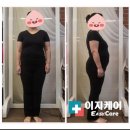 이지케어 이미지