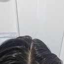 영양쎈타 분당점 | 성남 두피 관리 <엠지에프두피탈모 분당야탑점> 쿨링헤드스파 찐 후기
