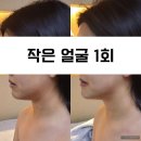 보떼피부관리샵
