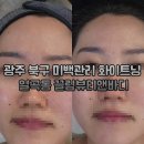 광주 북구 미백관리 화이트닝 일곡동 끌림뷰티앤바디