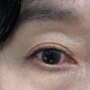 아이홀릭