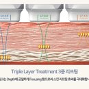 포항 리프팅, 피부과 시술 vs 관리실 케어? 현명한 선택법