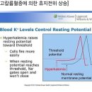 고칼륨혈증에 의한 휴지전위 상승 원리 헷갈립니다. 이미지