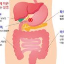 오른쪽 명치 통증 담적병 치료방법 원인 증상 진단 이미지