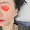 에스제이글로벌 | 남양주왁싱 에스제이슈가왁싱풀페이스왁싱 물광케어 후기
