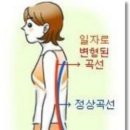 [디스크｜허리디스크] - '꼿꼿한 것도 병이다 '일자허리 (척추후만증) 이미지