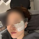 브이패스 | 강남 피부과 줌패스+피코슈어토닝 후기ㅣ기미 잡티 색소 통증 효과