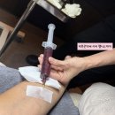 타임성형외과의원 | 대전 둔산동 희소성형외과 줄기세포주사 리얼후기