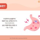 배꼽 주변 통증 배꼽 위통증 복부통증 원인 복통 근육통 맹장염 장폐색 위염 이미지