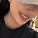 미소준치과기공소 | 무삭제라미네이트 블랙필름 내돈내산 후기
