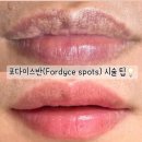 피부관리쉴