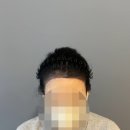 S헤어라인