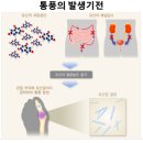 병요산업 | 옵티마[질병: 통풍] 후기