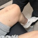 운동재활 이미지