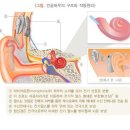 요양코리아-노인성난청의 치료 및 예방 이미지