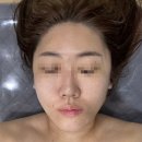 509 | 다산동에서 제대로 힐링하고 온 날, 채움테라피 얼굴 윤곽관리 &amp; 등관리 후기