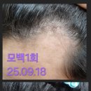 (주)엘카라 | “탈모 관리, 한 번에 되는 줄 알았던 분들 꼭 보세요”