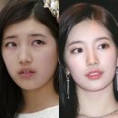 비비헤어라인