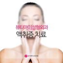 뷰티아이