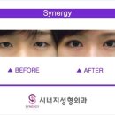 에스라인 이미지