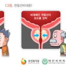 전립선 비대증 원인 증상 치료 전립선 비대증 예방법 이미지