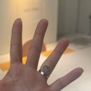 손가락하트문신 수지타투 제거 시술 1회차기록 내돈내산후기