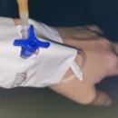 청주 우리항외과 치질 수술 후기(자세함 주의)