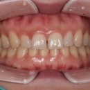 이건치과기공소 이미지