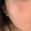 14-C | 잡티 비타민세럼 추천 칙칙한 피부톤 고민에 살림백서 제로 비타민C 히알루론 14% 세럼 사용 후기