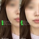 선2호 이미지