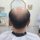 가발헤어샵