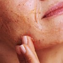 제이큐어(주) | 아픈여드름 완화부터 여드름피부관리법·여드름압출후관리까지 한 번에!