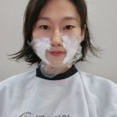 미희네 | 청담피부과 | 미희주사 | 팔자주름 콜라겐주사 일주일 후기