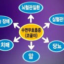 골다 이미지