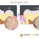 박치과 이미지