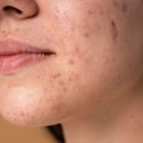 운정부부한의원 이미지