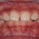 위례어린이치과의원 이미지