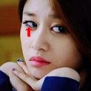 비전옵틱스 이미지