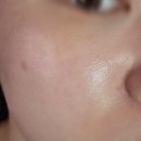 성동샤르망 오피스텔 | 종로/동대문 &#39;바이아이뷰티&#39; 기미 잡티 주근깨 제거 솔직 후기