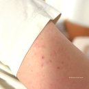 안림슈퍼 | 안림 테라파우더 생식 클렌즈주스 하루 한잔으로 피부트러블 벗어나기